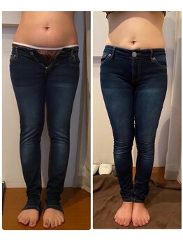 アネル 豊見城(anel)/