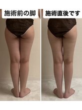 フェミニー(Feminy)/確実に！一度で！