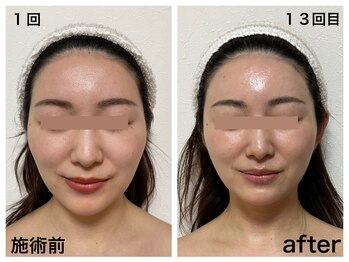 ダルセーニョ/「削らず骨格から導いた美しさ」