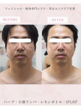 ユニクリア(Uni clear)/佐賀市│メンズフェイシャル