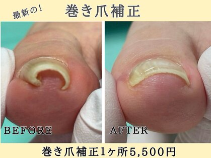 巻き爪補正店 金山店の写真