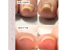 リケアネイル(Re:care nail)の雰囲気（アクリル施術で見た目も気にならない巻き爪ケア◎）