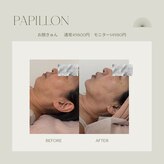 Papillon by Ｃｈｏｕ　Ｃｈｏｕ　【脂肪冷却/痩身/肌質改善/小顔たるみケア/北見市】