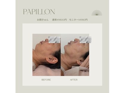 パピヨン バイ シュシュ 北見市(Papillon by Chou Chou)の写真