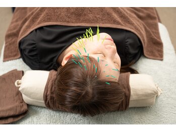 北梅田美容鍼灸院/【大阪/梅田】美容鍼は片側づつ