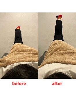 ナオル整体 福岡香椎院(NAORU整体)/30代女性施術事例【股関節】