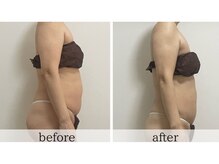 リュクス(LUXE)/50代/ぽっこりお腹解消