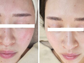 クレイルサロン(Claire salon)/ソフトハーブコース