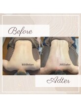 撫子アカデミー/慢性疲労