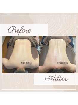 撫子アカデミー/慢性疲労