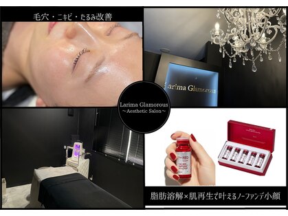 ラリマ グラマラス(Larima Glamorous)の写真