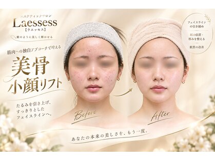 ラエッセス(A Laessess)の写真