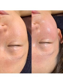 ナウ(now)/【陶肌トリートメント】