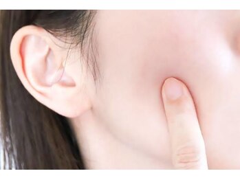 フロラスキン 心斎橋店(florasKIN)/肌質を変え陶器肌！