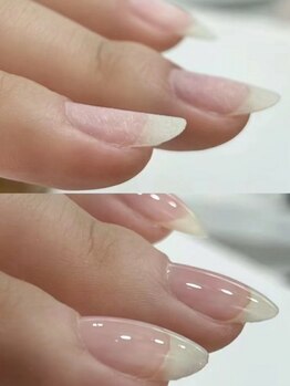 エイナネイル(einanail)の写真/自爪をいたわる『フィルイン』施術／爪に優しい『パラジェル』にも対応★『育爪』を始めてみませんか？