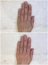 ネイルラボ レモンツリー(Nail Lab LEMON TREE)/Jessica美爪育成