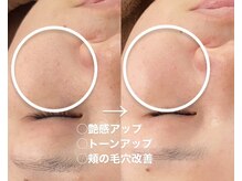 リアン(Lien)/水光肌ピーリング