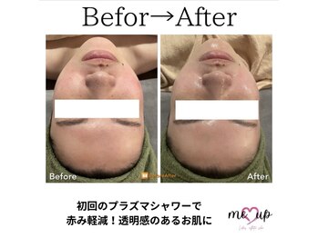 ミーアップ(Me up)/プラズマシャワー