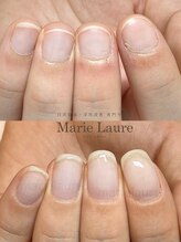 マリーロール 淀屋橋本店(Marie Laure)/深爪矯正/自爪育成/ネイルケア