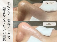 トネア 自由が丘店の雰囲気（１回でも効果を実感！[肌質改善/毛穴ケア/ニキビケア]）