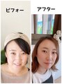 サルサナ(Salu Sana) 3ヶ月の結果!お友達から過去一痩せたね!と言われました♪
