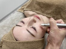 アルゴ 高槻店(ALGO)/↓毛穴洗浄ビフォーアフター