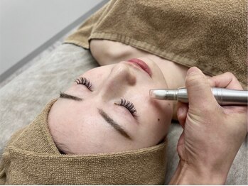 アルゴ 高槻店(ALGO)/↓毛穴洗浄ビフォーアフター