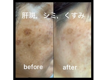 ココスタイルビューティー(COCOSTYLE beauty)の写真