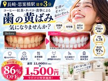 ホワイトニングショップ 長崎店