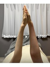 メゾン ド クロエ(Maison de Chloe)/CHLOE式パーソナル痩身