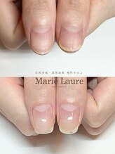 マリーロール 淀屋橋本店(Marie Laure)/自爪育成/深爪矯正/ネイルケア