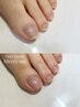 【FOOT】ごっそり実感♪角質甘皮周りケアコース　¥7000→¥6500
