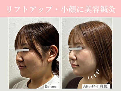 リマナ(Limana)の写真