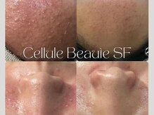 エターナル(Eternal)