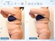 クレンズ(CLeanse)の写真