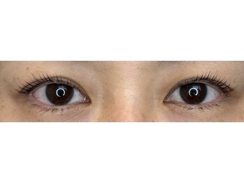 アールエム(Rm)/8月◇まつげ