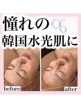 ホワイトアクア 錦糸町店(WHITE AQUA)/ララピール/東京/錦糸町