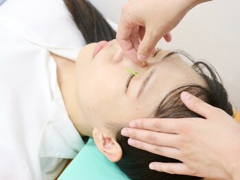 ノモコツ鍼灸 整骨院 西神戸院(NOMOKOTSU鍼灸 整骨院)/+…施術風景…+　【美容鍼】