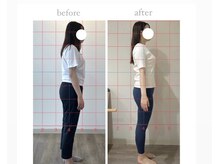 ルア(Lua)の雰囲気（before/after◎継続は力なり！1回のセッションでも違いを体感◎）