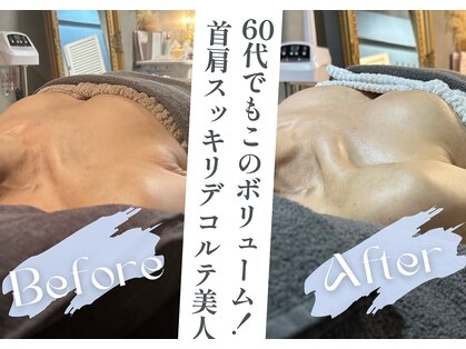 なないろバスト 新宿東口(nanairoバスト)の写真