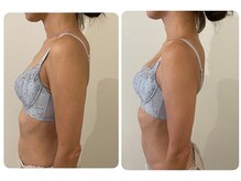 モナンジュ(ramonange)/姿勢改善　