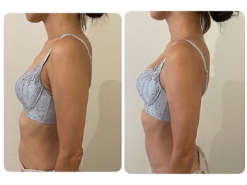 モナンジュ(ramonange)/姿勢改善　