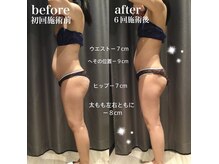 アイスタイル(i-style)の雰囲気（泉大津で唯一の脂肪冷却痩身サロン♪お腹、足、二の腕、背中♪）