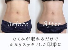 サロン(SALON)の雰囲気(【術後ケア施術例】ダウンタイムを最小限に抑えます!)