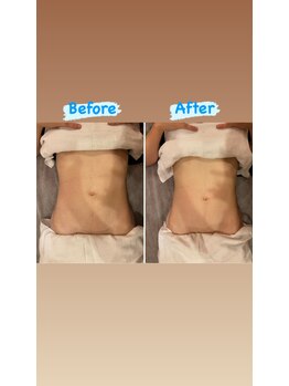 アース 稲毛海岸店(HAIR & MAKE EARTH)/ボディケア