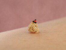 ゆり鍼灸院/お灸施術で使う直接灸