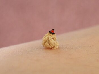 ゆり鍼灸院/お灸施術で使う直接灸