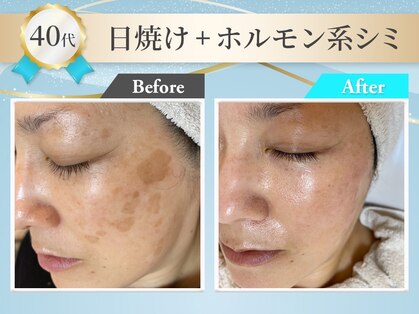 グランシス 水戸店の写真