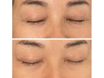 ジーニー(Genie)/ララピール始まってます