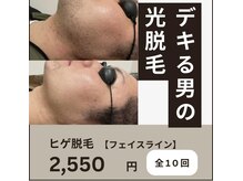 ネクスト 伊勢店(NEXT)/フェイスライン脱毛